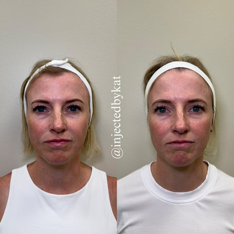 Before and after
