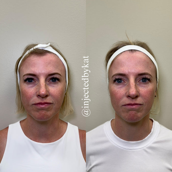 Under Eye Refresh